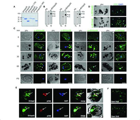 Escrt Iii Proteins Are Located In Cytoplasm Vesicles Nuclei And