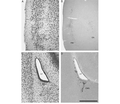 Photomicrographs Showing The Piriform Cortex Pir And The Nucleus Download Scientific Diagram