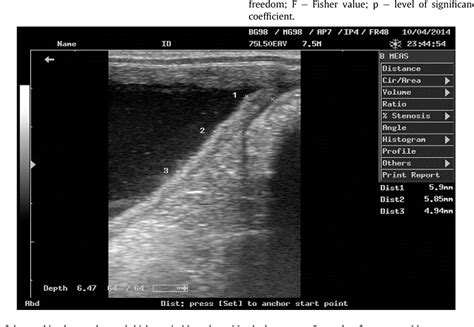 Figure From Transrectal Ultrasonography For Measuring Of Combined