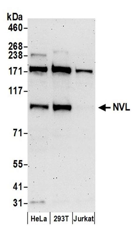 Nvl Polyclonal Antibody A304 863a T