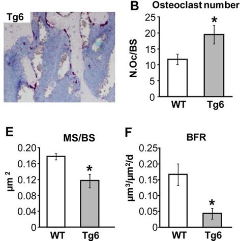 Increased Osteoclastogenesis And Reduced Bone Formation In Transgenic