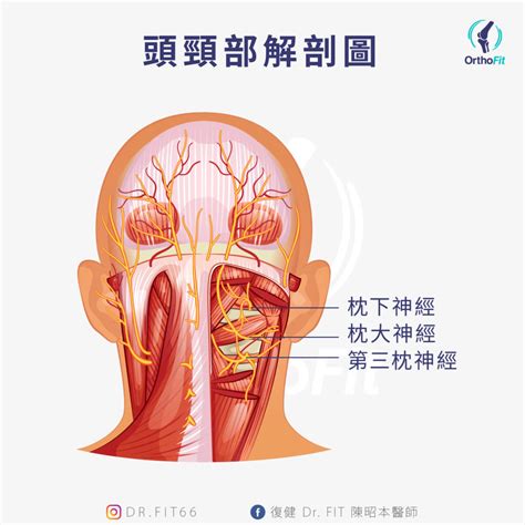 頭痛可能是脖子枕神經炎 Orthofit陳昭本醫師