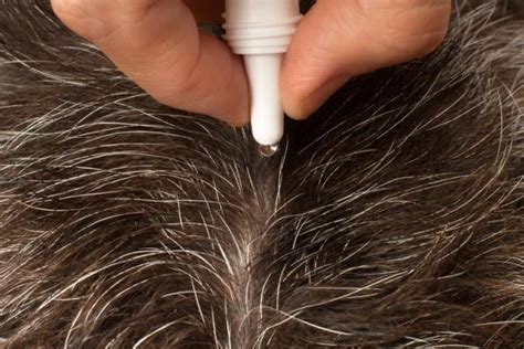 Pueden Las Pulgas Vivir En El Cabello Humano Zeroplagas