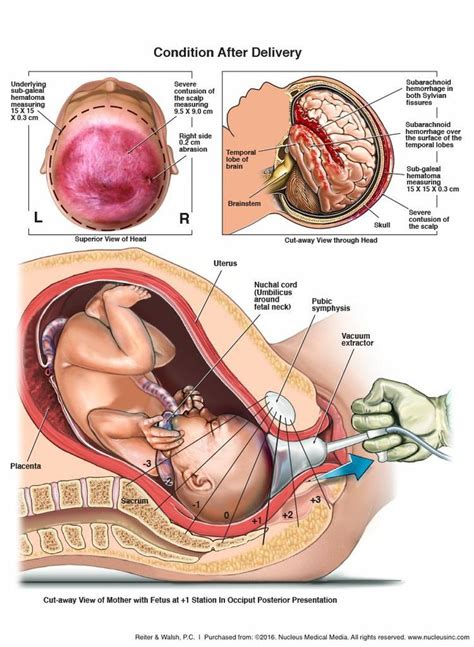 Pin By Gelsy Eliane On Estudos Yahweh Yeshua Messias Medical