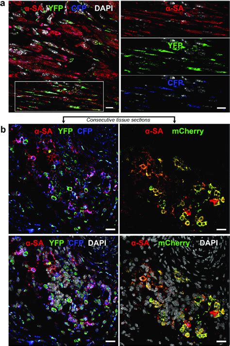 C Kit Bmcs Acquire The Cardiomyocyte Lineage A The White Rectangle In Download Scientific