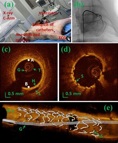 Pencil Beam Scanning Catheter For Intracoronary Optical Coherence