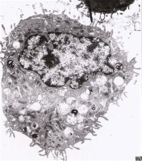 Micrografía electrónica perteneciente a célula transfectada Q6 GM