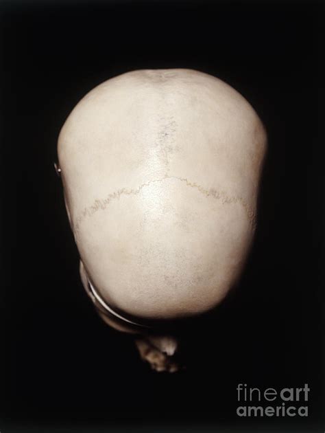 Female Human Skull Photograph by John Davis / Dorling Kindersley