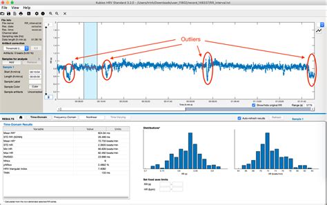 Reporting Hexoskin Data Into Kubios HRV Standard