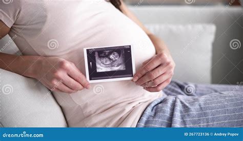 Pregnant Woman with Ultrasound Image Stock Photo - Image of bedroom, pregnancy: 267723136