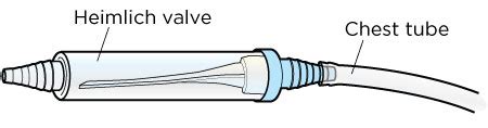 Caring For Your Chest Tube And Heimlich Valve Memorial Sloan