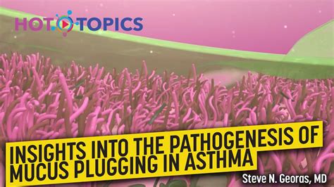 Insights Into The Pathogenesis Of Mucus Plugging In Asthma Youtube