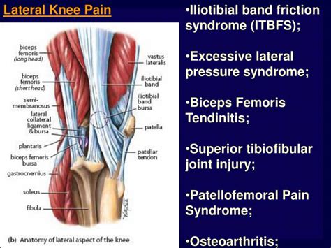 Posterior Knee Pain Causes