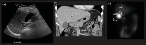 Imaging of Pediatric Diseases | Radiology Key