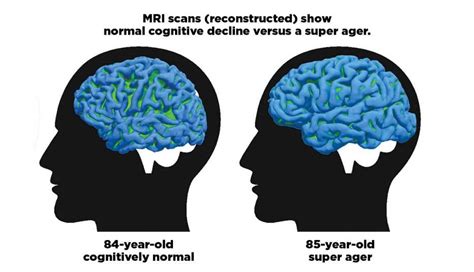 Go Inside The Mind Of Super Agers