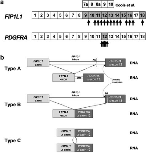 Distribution Of Breakpoints Within Fip1l1 And Pdgfra Exon Numbering Is