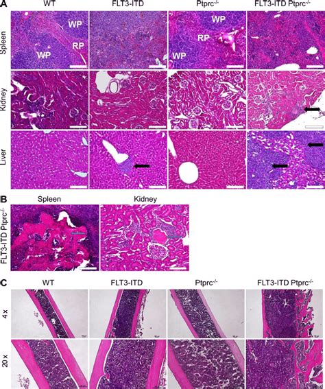 Histopathology Of Flt Itd Mice Inactivated For Ptprc A H E Stained