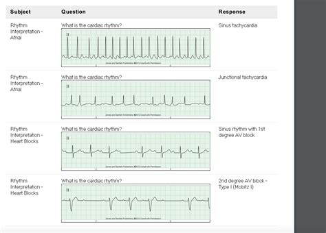 Relias Dysrhythmia Basic A Test Answers 2024 Solution Relia