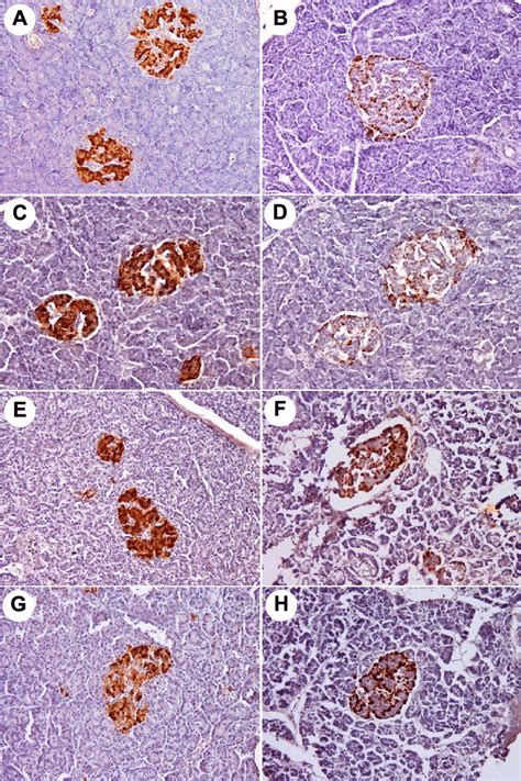 The Immunohistochemical Staining For Insulin And Glucagon