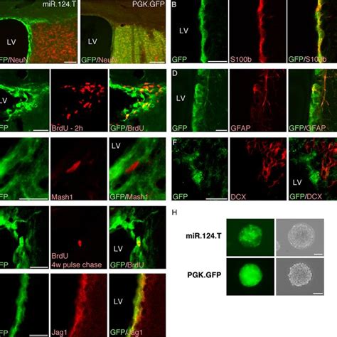 Characterization Of MiR 124 T Mice A Adult MiR 124 T Mice Display Low