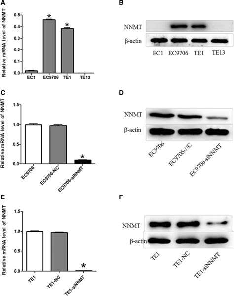 NNMT Expression In ESCC Cell Lines And Knockdown Efficiency Of NNMT