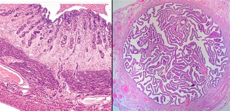 Female Reproductive Histology Uterus And Fallopian Tube Diagram Quizlet