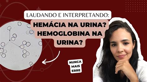 Hemoglobina Negativa Na Urina LIBRAIN