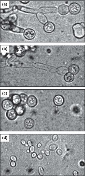 Pseudomycelial Growth And Chlamydospore Production By C Dubliniensis