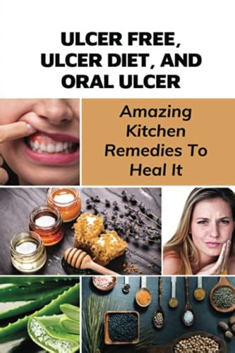 Ulcer Free, Ulcer Diet, And Oral Ulcer: Amazing Kitchen Remedies To ...