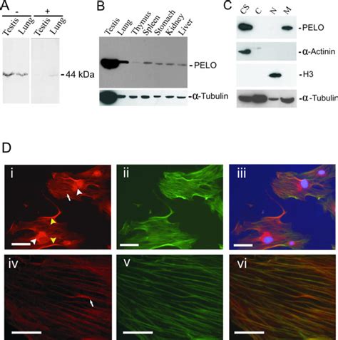 Subcellular Localization Of Pelo At The Cytoskeleton A Competition