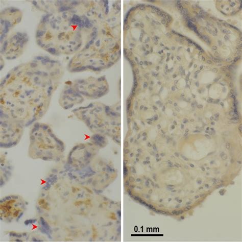 Immunohistochemical Visualization Of The Receptor Cx Cr In Perfused