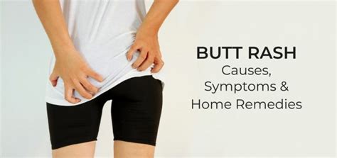 Butt Rash Possible Causes Symptoms And Remedies Daily Health Cures