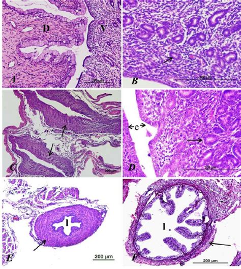 Photomicrograph Of The Cervix Double Uterus And Uterine Tube Of G