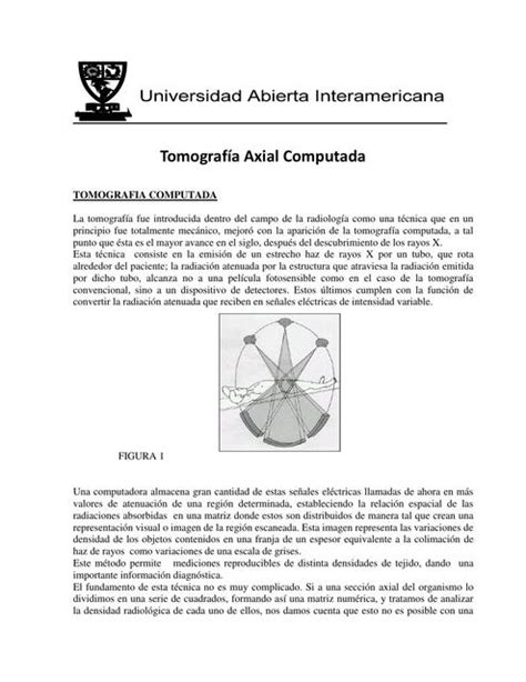 Tomograf A Axial Computada Sofia Masia Udocz