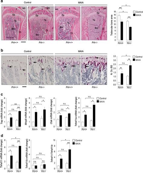 Trabecular Bone Area Is Reduced And Osteoclastogenesis Is Enhanced In