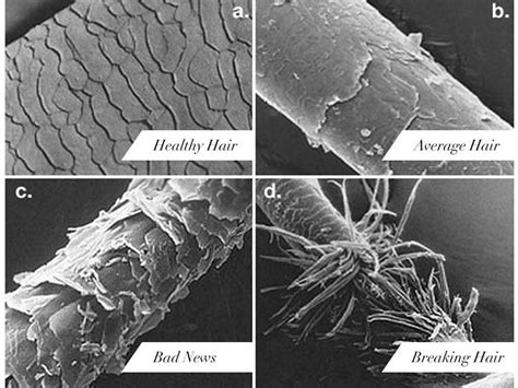 Hair Under A Microscope Medical Student Pinterest