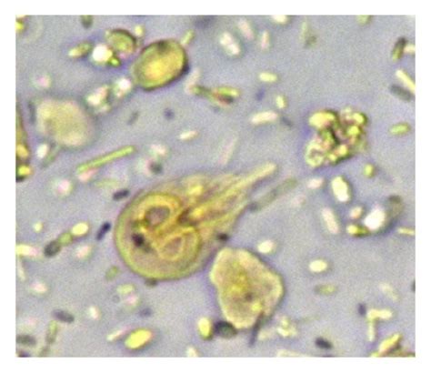 Fecal Smears From A 6 Month Old Female Maine Coon Cat With Chronic Download Scientific Diagram