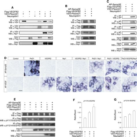 VEGFR2 KDR Flk1 Signaling Mediates Axon Growth In Response To