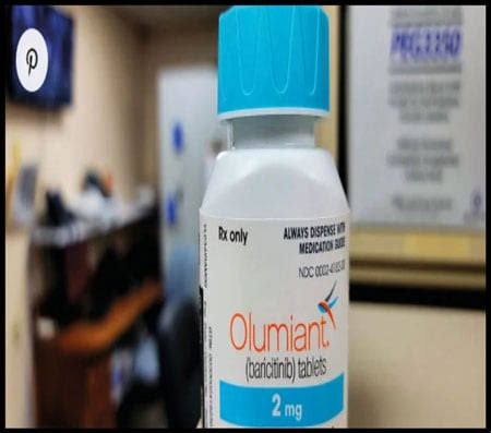 Alopecia Fda Approves Olumiant For Hair Loss Treatment Pakistan Observer