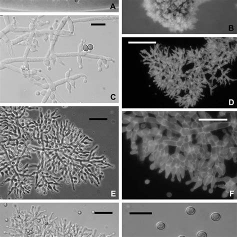 Trichoderma Theobromicola A And B Pustules Formed On Cmd Note The