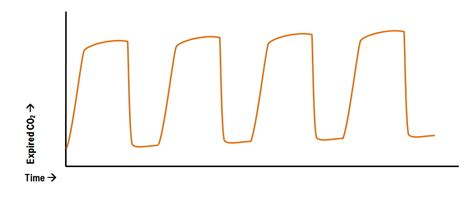 End-tidal capnometry waveform interpretation | Deranged Physiology