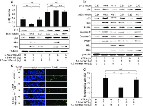 Hbx Impairs The Ability Of Atra To Induce P53 Dependent Apoptosis