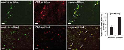 Fluorescence Double Staining Of Orexin A Green And Cfos Red Ad