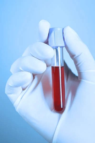 Test Tubes With Blood In Hand On Blue Background Stock Photo By