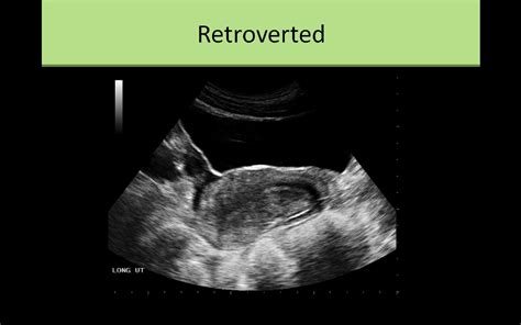 Pregnancy doctor games iphone, pregnant retroverted uterus pictures, bleeding in 40 weeks pregnant