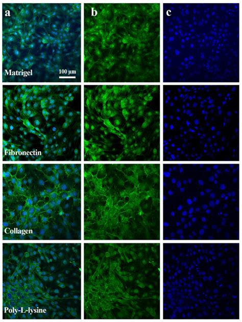 Expression Of E Cadherin Protein Immunostaining In Hepg2 Cell Line