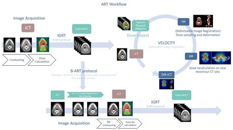 Workflow Of Our Institutional Best Adaptive Radiotherapy Protocol Download Scientific Diagram