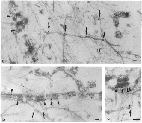 Immuno Electron Microscopic Localization Of Ppl At Desmosomal