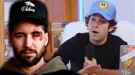 What Happened With David Dobrik And Jeff Wittek? Accident