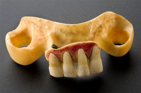 When Dentures Used Real Human Teeth - Atlas Obscura